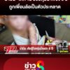 น้ำปั่น-เด็ก-12-ป่วยตุ่มน้ำพอง-6-ปี-ถูกเพื่อนล้อเป็นตัวประหลาด-|-ลุยชนข่าว-ออนไลน์-|-8-พ.ค