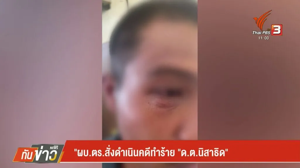 ผบตรสั่งดำเนินคดีเด็ดขาด-ชายฉกรรจ์รุมทำร้าย-ตำรวจประจำหน่วยเ