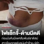 อดีตสาวแดนเซอร์-ร้องเพจดังเมืองบ้านดุง-ถูกแฟนหนุ่มที่เพิ่งรู้จักเพียง-2-เดือน-ทำร้ายร่างก