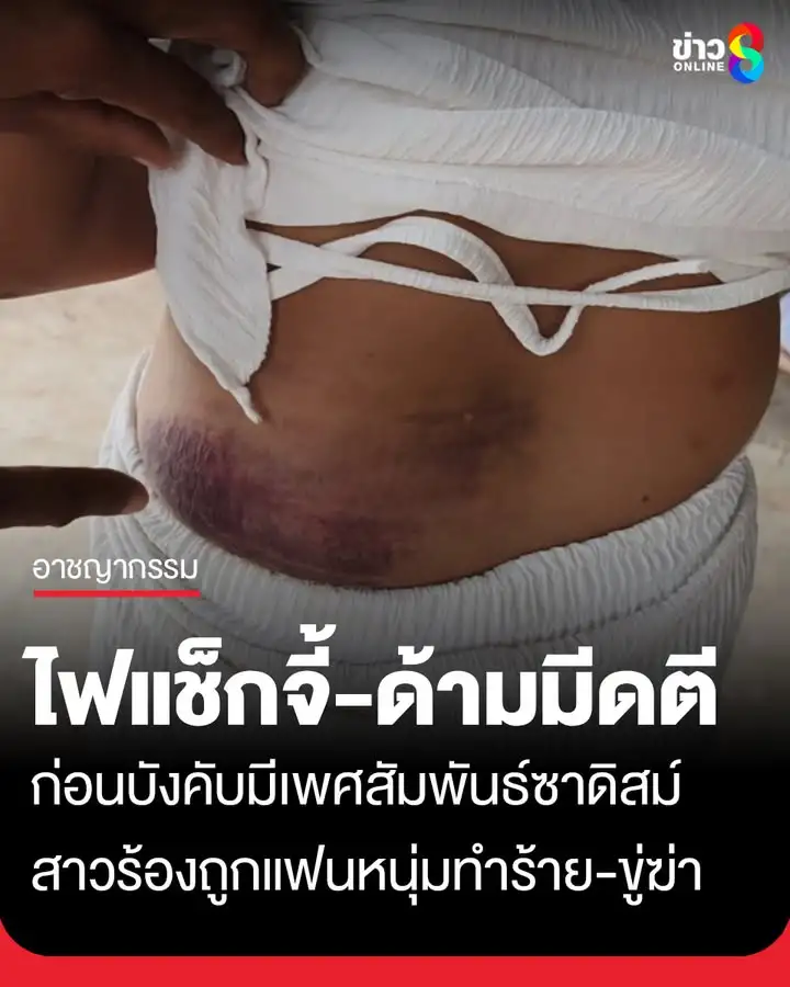 อดีตสาวแดนเซอร์-ร้องเพจดังเมืองบ้านดุง-ถูกแฟนหนุ่มที่เพิ่งรู้จักเพียง-2-เดือน-ทำร้ายร่างก