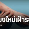 เฝ้าระวังป้องกันโรคฝีดาษวานร-จ.เชียงใหม่-สถานการณ์โรคฝีดาษวา
