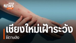 เฝ้าระวังป้องกันโรคฝีดาษวานร-จ.เชียงใหม่-สถานการณ์โรคฝีดาษวา