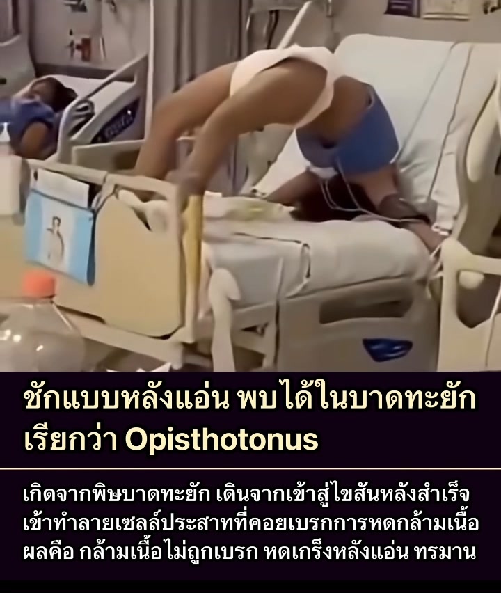 -เหตุผลที่-ทาง-โรงพยาบาลต้องฉีดวัคซีนบาดทะยัก-หากถูกตะปูตำ-ถูกของ