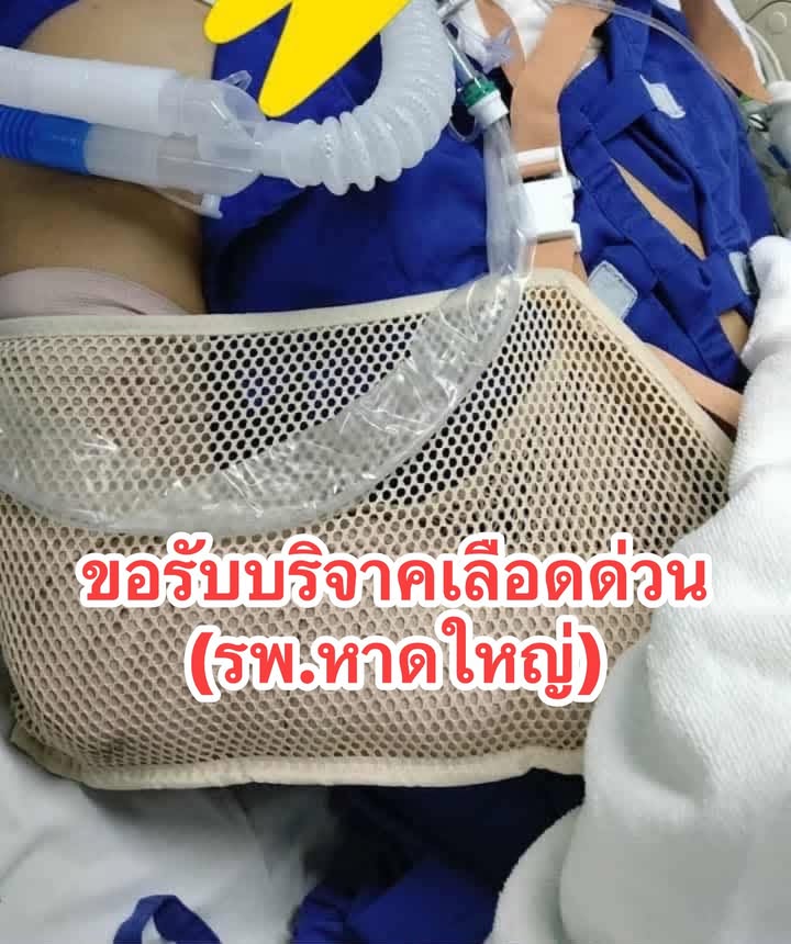 รับบริจาคเลืoด-หาดใหญ่-สวัสดีคับ-ตอนนี้พี่ชายผมอยู่ห้อง-ic-|-2025-09-27-07:41:00