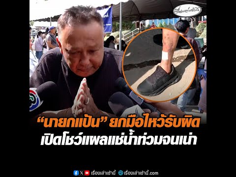 นายกแป้น ยกมือไหว้รับผิด เปิดโชว์แผลแช่น้ำท่วมจนเน่า อัพเดทข่าว