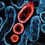 สธ.-แถลงยังไม่พบผู้ป่วยไวรัสนิปาห์ในไทย-ชี้ผู้ติดเชื้อยืนยันในอินเดียเป็นบุคลากรการแพทย