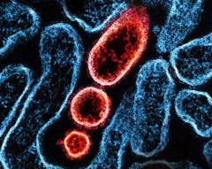 สธ.-แถลงยังไม่พบผู้ป่วยไวรัสนิปาห์ในไทย-ชี้ผู้ติดเชื้อยืนยันในอินเดียเป็นบุคลากรการแพทย