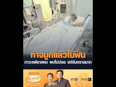 ทำจมูกแล้วไม่ฟื้น ภาวะแพ้ยาสลบ พบไม่บ่อย แต่อันตรายมาก อัพเดทข่าว