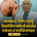 หมอยง-ให้ความรู้-“โรคไข้กาฬหลังแอ่น”-หลังพบระบาดหนักที่อังกฤ-|-2026-03-18-03:23:00