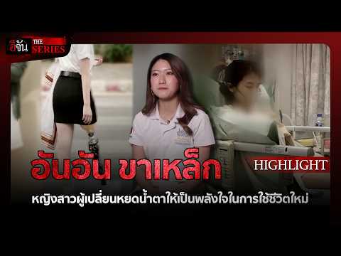 ด่วน อันอัน ขาเหล็ก: ปาฏิหาริย์เกิดใหม่ | อีจัน THE SERIES Highlight