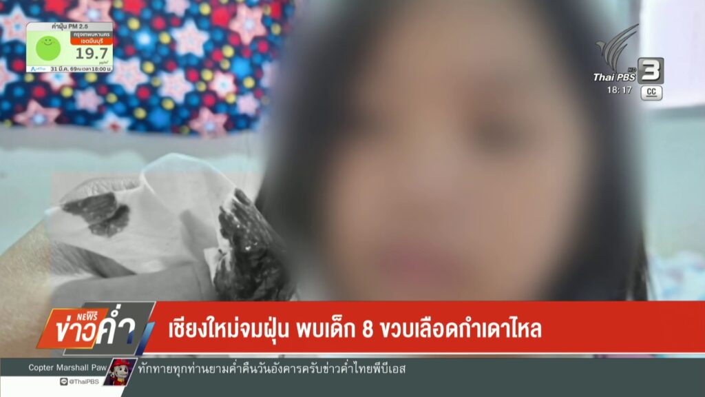 เชียงใหม่จมฝุ่น-พบเด็ก-8-ขวบเลืoดกำเดาไหล-(feed--wi