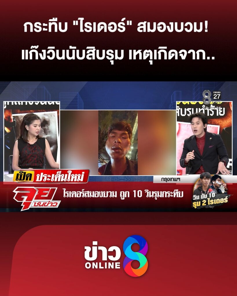 กระทืบ-“ไรเดอร์”-สมองบวม