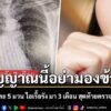 วันที่-26-พฤษภาคม-2569-เพจเฟซบุ๊ก-เรียนหมอ-by-หมอแกว-หมอแนต
