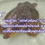 -ช่วยชีวิต-เต่าหัวค้อน-ป่วยลอยอ่อนแรงในแม่น้ำประแส-จ.ระย
