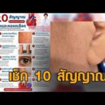 สรยุทธ เจอ 3 ข้อ สถาบันโรคทรวงอก เผย 10 สัญญาณ อาจบ่งบอกความเสี่ยงโรคหัวใจและหลอดเลืoด อัพเดทข่าว