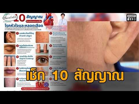 สรยุทธ เจอ 3 ข้อ สถาบันโรคทรวงอก เผย 10 สัญญาณ อาจบ่งบอกความเสี่ยงโรคหัวใจและหลอดเลืoด อัพเดทข่าว