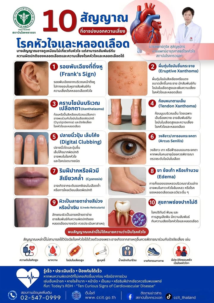 10-สัญญาณ-ที่อาจบ่งบอกความเสี่ยงโรคหัวใจและหลอดเลืoด-️️‍