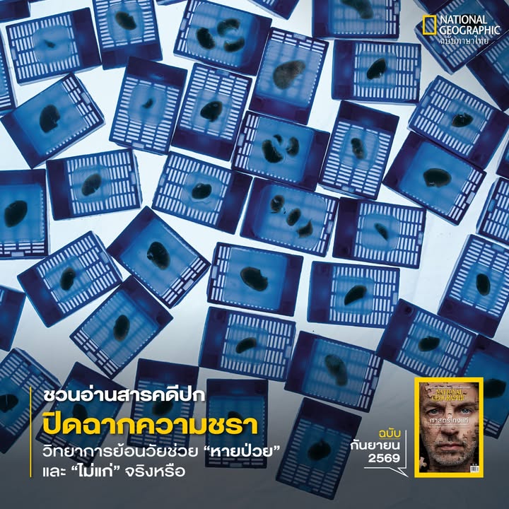 ภาพเซลล์เนื้อเยื่อตับชิ้นใหญ่น้อยของมนุษย์จำนวนมาก-ซึ่งอยู่ร