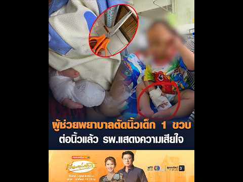 ผู้ช่วยพยาบาลตัดนิ้วเด็ก 1 ขวบ ต่อนิ้วแล้ว โรงพยาบาลแสดงความเสียใจ อัพเดทข่าว