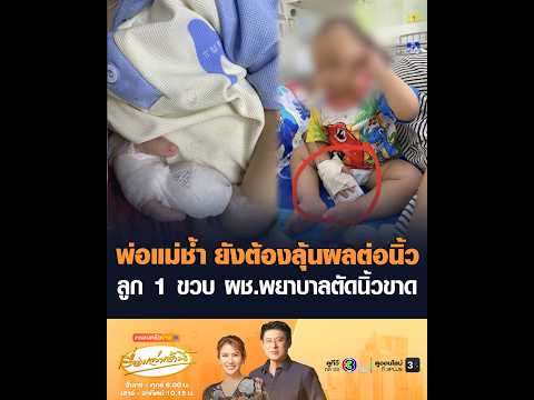 พ่อแม่ช้ำ ยังต้องลุ้นผลต่อนิ้วลูก 1 ขวบ ผช.พยาบาลตัดนิ้วขาด อัพเดทข่าว