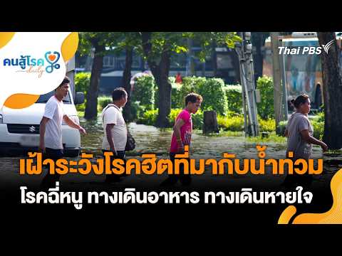 เฝ้าระวังโรคฮิตที่มากับน้ำท่วม โรคฉี่หนู ทางเดินอาหาร ทางเดินหายใจ | คนสู้โรค Day-to-day 29 ก.ย.69