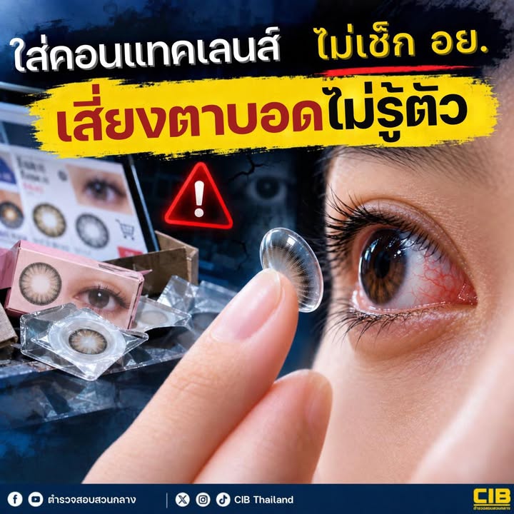 ใส่คอนแทคเลนส์ไม่เช็ก-อย-เสี่ยงตาบอดไม่รู้ตัว️.-คอนแทค